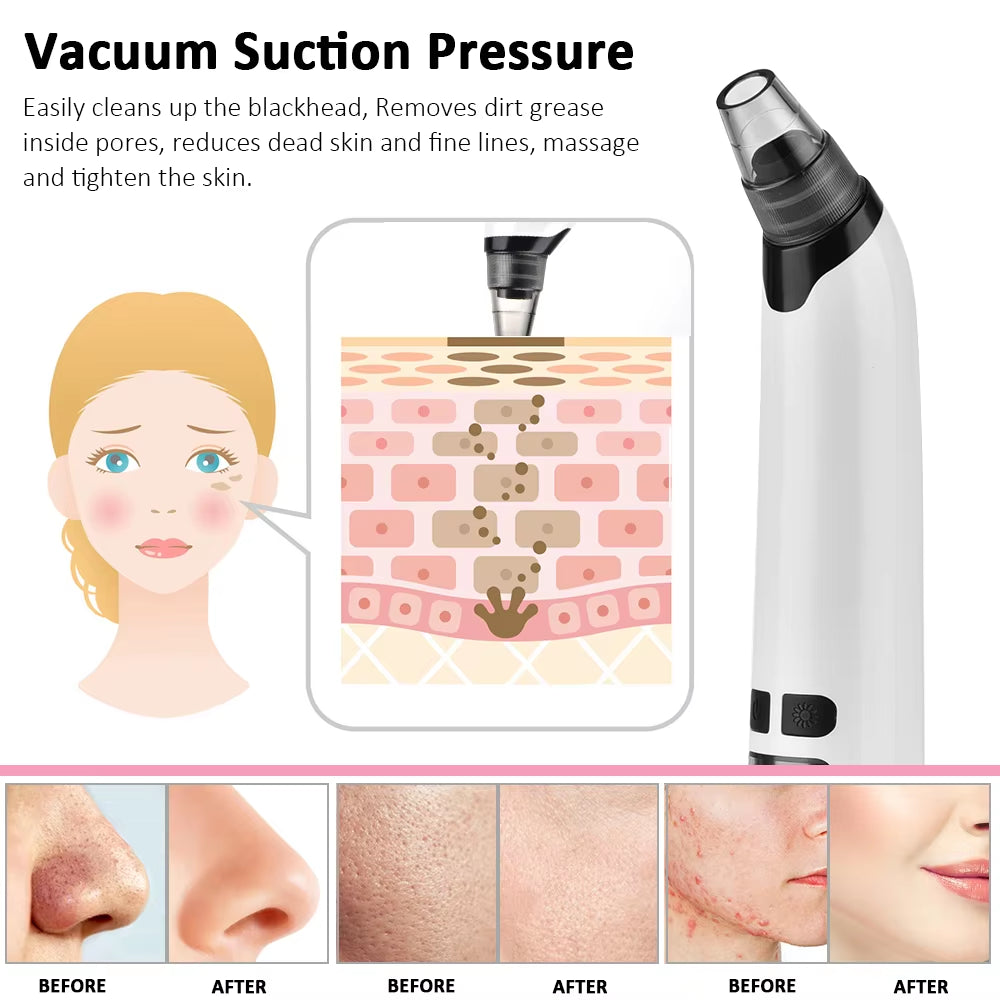 Facial Cleaner Nose Blackhead Remover Deep Pore Acne Pimple Removal Vacuum Suction Diamond T Zone Beauty Tool USB Face Household